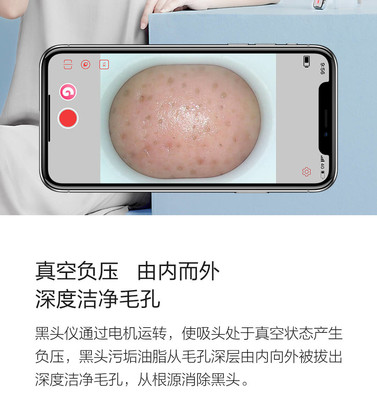 小米有品媄拾智能可视吸黑头仪 告别黑头，开启“眼见为实”的清洁新时代